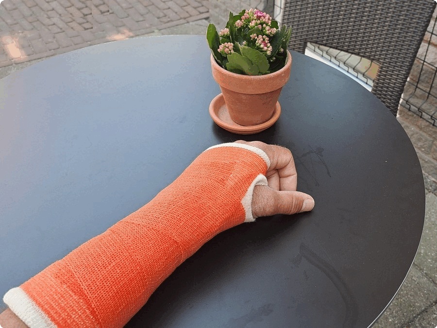 In afwachting van de ingreep krijg ik 'loopgips', mooi oranje van kleur.